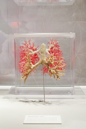 Check out our thoughts on the Real Bodies Exhibit at Bally's Las Vegas on Home in High Heels