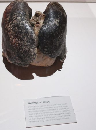 Check out our thoughts on the Real Bodies Exhibit at Bally's Las Vegas on Home in High Heels